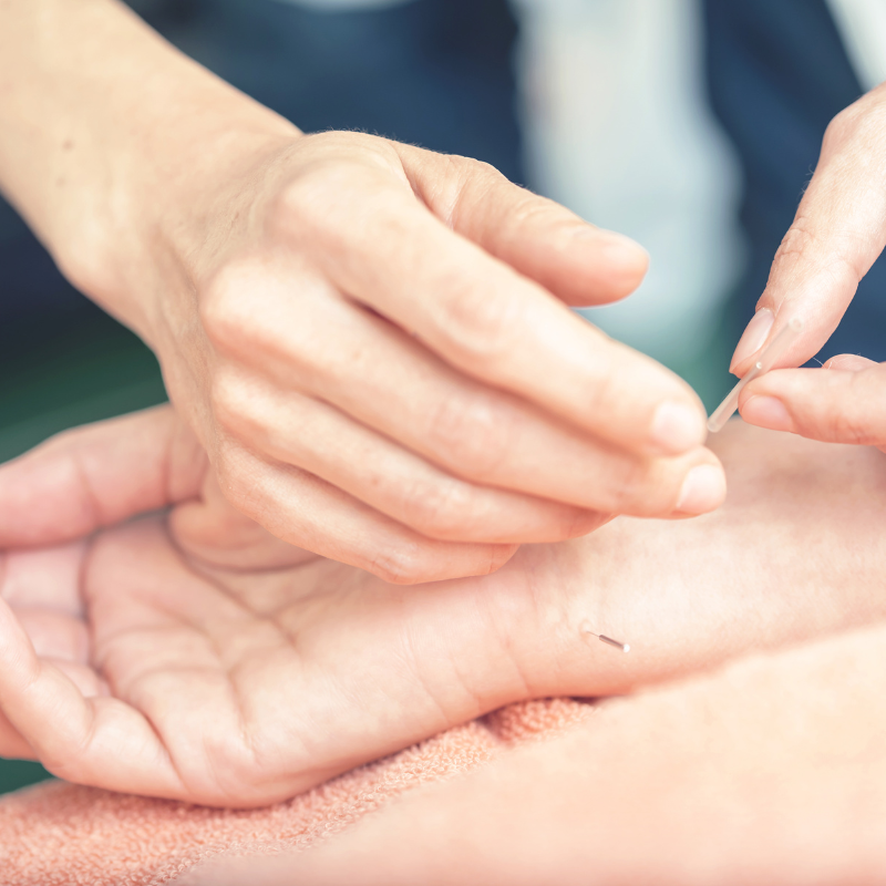 Prenatal Acupuncture